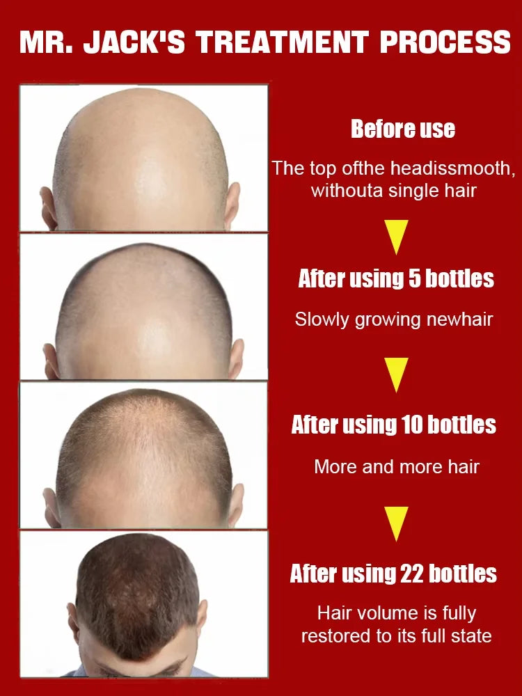 30 ml ZKRICARO haarmassageolie Maak het haar steeds mooier