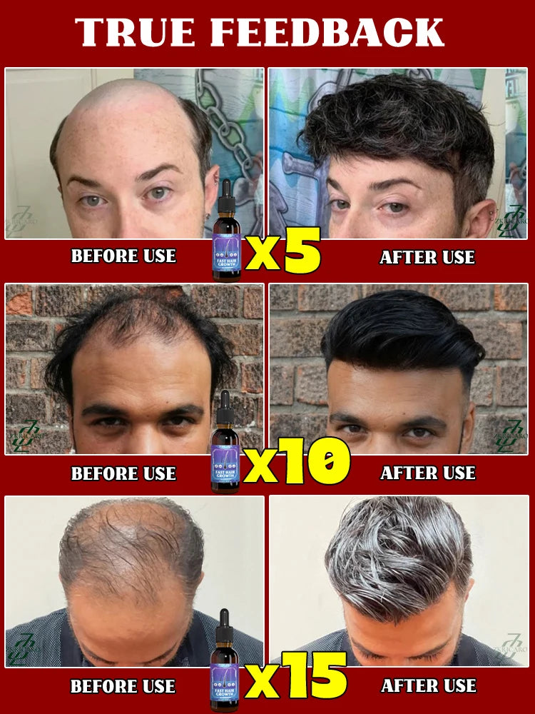 30 ml ZKRICARO haarmassageolie Maak het haar steeds mooier