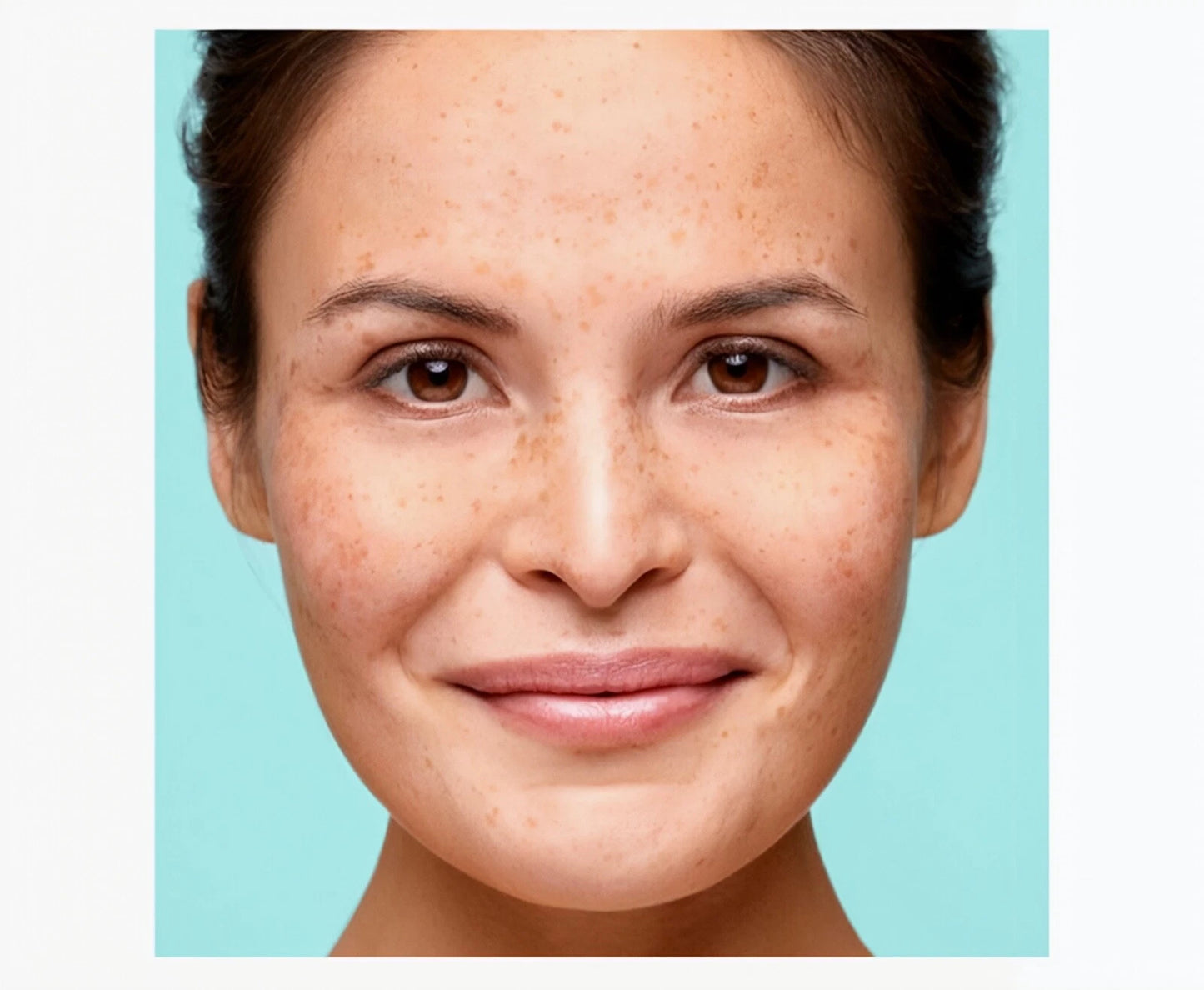 Biodermal Pigmentserum - Pigmentvlekken creme - Vermindert pigmentvlekken - 30ml